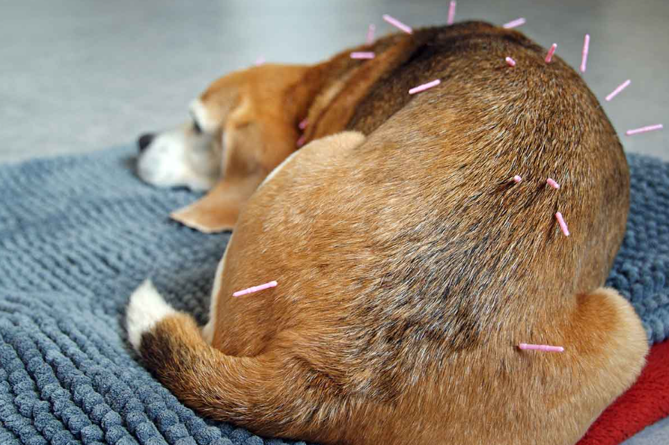 acupuncture